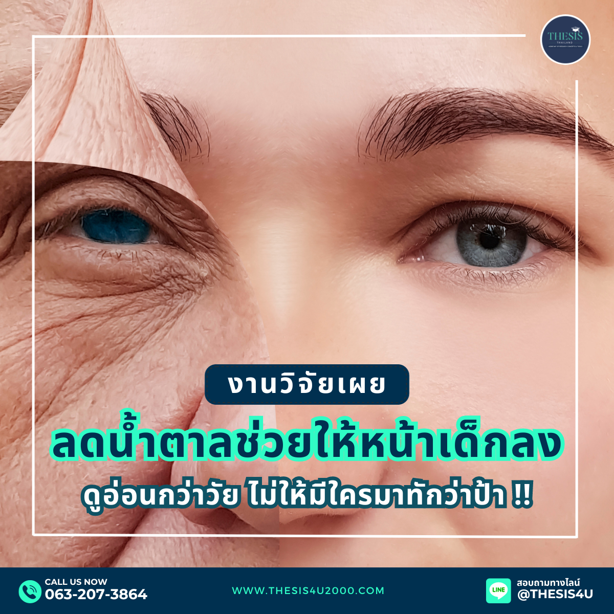 งานวิจัยเผย : การลดน้ำตาลช่วยให้หน้าเด็กลง